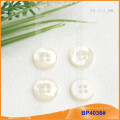 Polyester button/Plastic button/Resin Shirt button for Coat BP4036